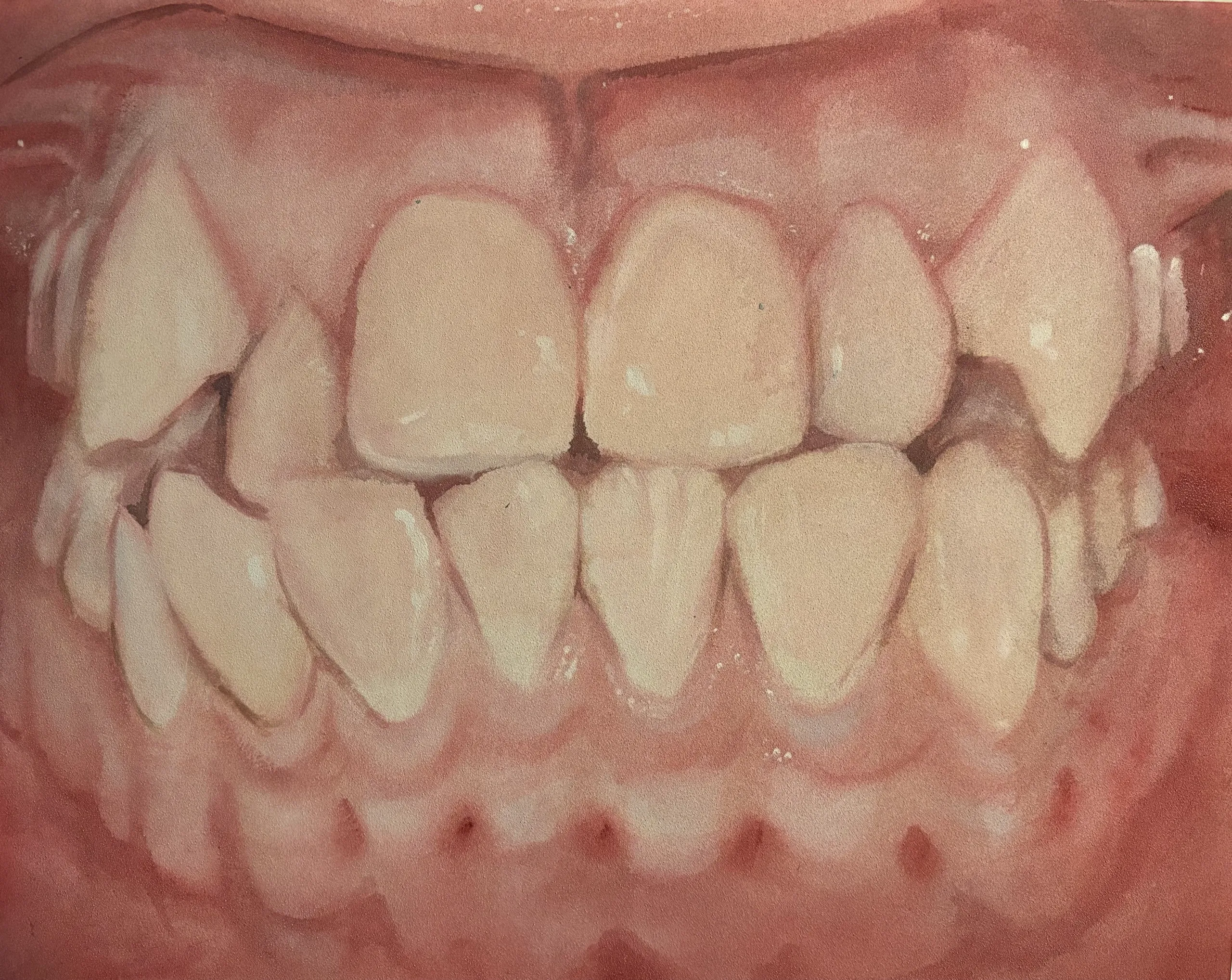 Gnashers